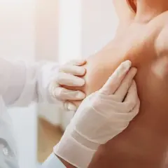Jak zmniejszyć torbiele w piersiach: 8 skutecznych metod