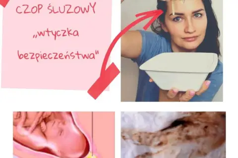 Wypadł czop śluzowy? Poznaj prawdę o początku porodu
