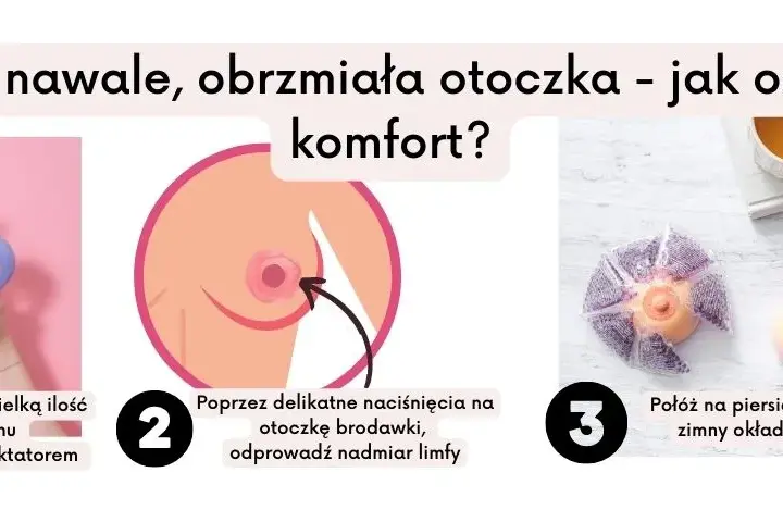 Nawał pokarmu po porodzie - skuteczne sposoby na ulgę i wygodne karmienie