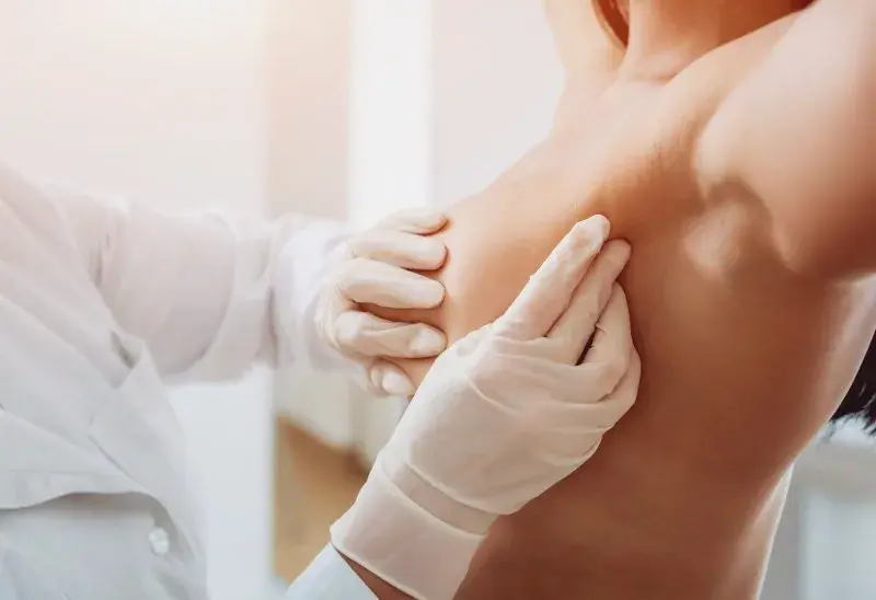 Jak zmniejszyć torbiele w piersiach: 8 skutecznych metod